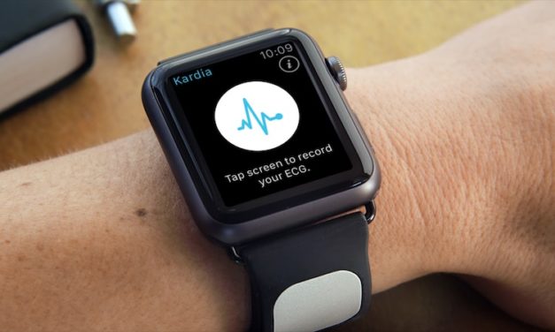 FDA одобри медицинската каишка Kardia Band EKG за Apple Watch